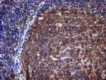 RUVBL2 Antibody in Immunohistochemistry (Paraffin) (IHC (P))