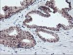 GADD34 Antibody in Immunohistochemistry (Paraffin) (IHC (P))