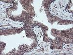 GADD34 Antibody in Immunohistochemistry (Paraffin) (IHC (P))