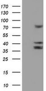 CYP2B6 Antibody in Western Blot (WB)