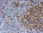 PSMB9 Antibody in Immunohistochemistry (Paraffin) (IHC (P))