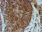 PSMB9 Antibody in Immunohistochemistry (Paraffin) (IHC (P))