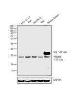 PSMB9 Antibody in Western Blot (WB)