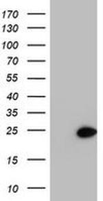 PSMB9 Antibody in Western Blot (WB)