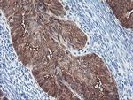 BCAT1 Antibody in Immunohistochemistry (Paraffin) (IHC (P))