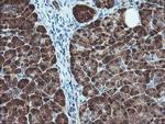 BCAT1 Antibody in Immunohistochemistry (Paraffin) (IHC (P))