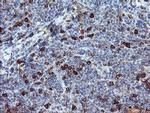 BCAT1 Antibody in Immunohistochemistry (Paraffin) (IHC (P))