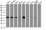 BCAT1 Antibody in Western Blot (WB)