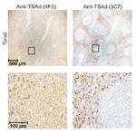 SH2D2A Antibody in Immunohistochemistry (Paraffin) (IHC (P))