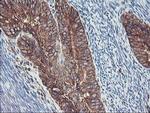 SH2D2A Antibody in Immunohistochemistry (Paraffin) (IHC (P))