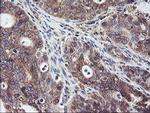 SH2D2A Antibody in Immunohistochemistry (Paraffin) (IHC (P))