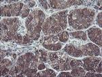 SH2D2A Antibody in Immunohistochemistry (Paraffin) (IHC (P))