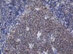 ACD Antibody in Immunohistochemistry (Paraffin) (IHC (P))