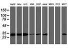 PSMB7 Antibody in Western Blot (WB)