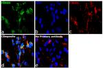 PSMB9 Antibody in Immunocytochemistry (ICC/IF)