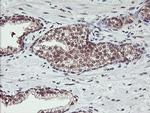 HLCS Antibody in Immunohistochemistry (Paraffin) (IHC (P))