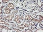 TMEFF2 Antibody in Immunohistochemistry (Paraffin) (IHC (P))