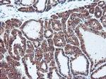 PSMB7 Antibody in Immunohistochemistry (Paraffin) (IHC (P))