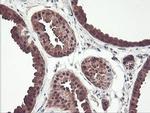 PSMB7 Antibody in Immunohistochemistry (Paraffin) (IHC (P))