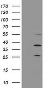 PSMB7 Antibody in Western Blot (WB)