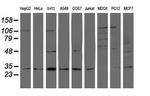 PSMB7 Antibody in Western Blot (WB)