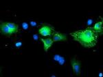 SCHIP1 Antibody in Immunocytochemistry (ICC/IF)