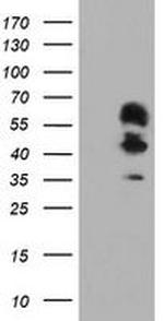 SCHIP1 Antibody in Western Blot (WB)