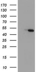 Carboxypeptidase A1 Antibody in Western Blot (WB)