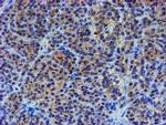 LIM1 Antibody in Immunohistochemistry (Paraffin) (IHC (P))