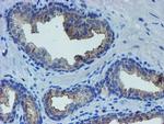 LIM1 Antibody in Immunohistochemistry (Paraffin) (IHC (P))