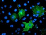 TMEFF2 Antibody in Immunocytochemistry (ICC/IF)