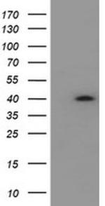 HSD17B2 Antibody in Western Blot (WB)