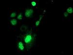 SAT2 Antibody in Immunocytochemistry (ICC/IF)