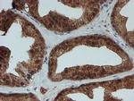 SAT2 Antibody in Immunohistochemistry (Paraffin) (IHC (P))