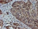 SAT2 Antibody in Immunohistochemistry (Paraffin) (IHC (P))