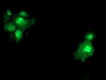 SAT2 Antibody in Immunocytochemistry (ICC/IF)