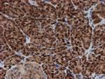 SAT2 Antibody in Immunohistochemistry (Paraffin) (IHC (P))