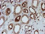 SAT2 Antibody in Immunohistochemistry (Paraffin) (IHC (P))