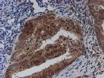 SAT2 Antibody in Immunohistochemistry (Paraffin) (IHC (P))