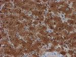 SAT2 Antibody in Immunohistochemistry (Paraffin) (IHC (P))