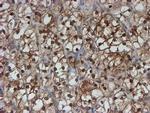 SAT2 Antibody in Immunohistochemistry (Paraffin) (IHC (P))