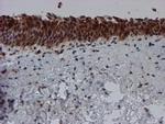 SAT2 Antibody in Immunohistochemistry (Paraffin) (IHC (P))