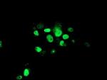 ATRIP Antibody in Immunocytochemistry (ICC/IF)