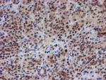 ATRIP Antibody in Immunohistochemistry (Paraffin) (IHC (P))