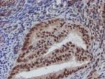 ATRIP Antibody in Immunohistochemistry (Paraffin) (IHC (P))