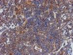 ATRIP Antibody in Immunohistochemistry (Paraffin) (IHC (P))