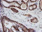 ATRIP Antibody in Immunohistochemistry (Paraffin) (IHC (P))