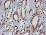 ATRIP Antibody in Immunohistochemistry (Paraffin) (IHC (P))