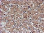 ATRIP Antibody in Immunohistochemistry (Paraffin) (IHC (P))