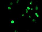 METT10D Antibody in Immunocytochemistry (ICC/IF)